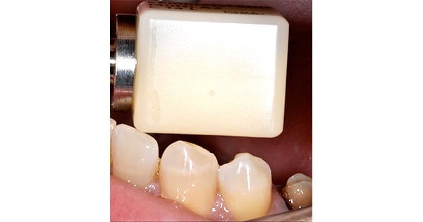 empress multi pour cerec v2