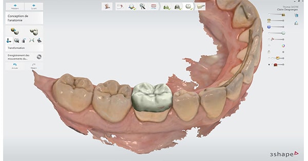 logiciel Design Studio 3Shape